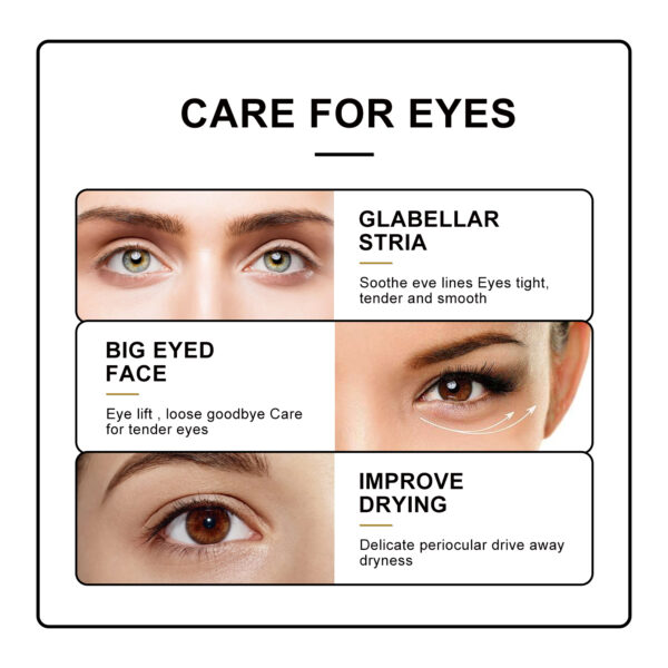 548826871 Eye Roller Eye Cream Ball Massage To Reduce Fine Lines, Bags, Puffiness And Dark Circles Around The Eyes