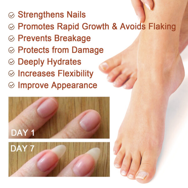 7 Day Nail Care Essence Grey Nail, Hand, Foot And Nail Nourishing Cleansing Essence