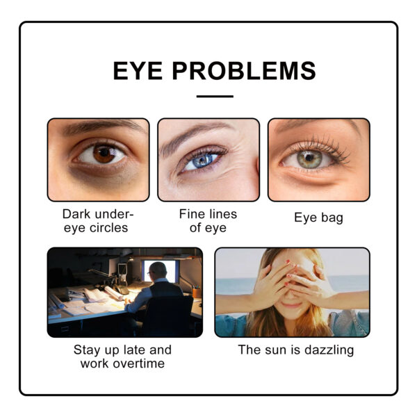 548826870 Eye Roller Eye Cream Ball Massage To Reduce Fine Lines, Bags, Puffiness And Dark Circles Around The Eyes