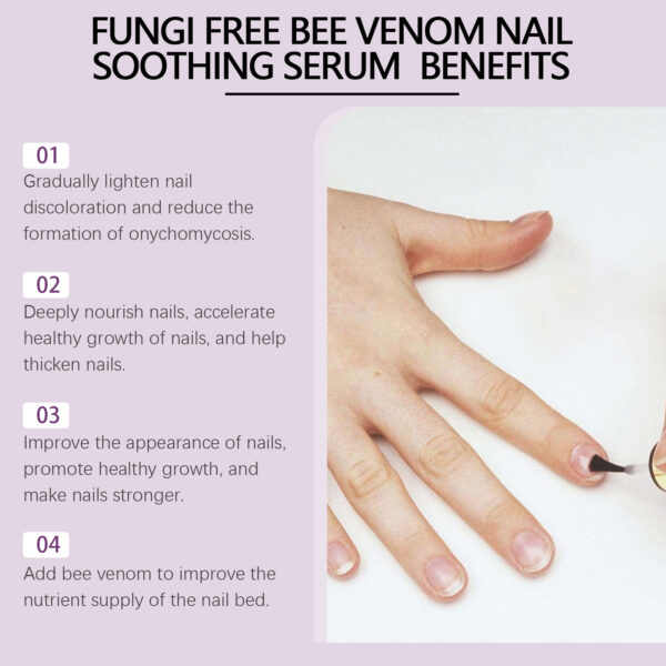 Bee Venom Grey Nail Care Solution For Hand And Foot Nails Cleansing Nutrition Repair Brightening Rotten Nails Thickening