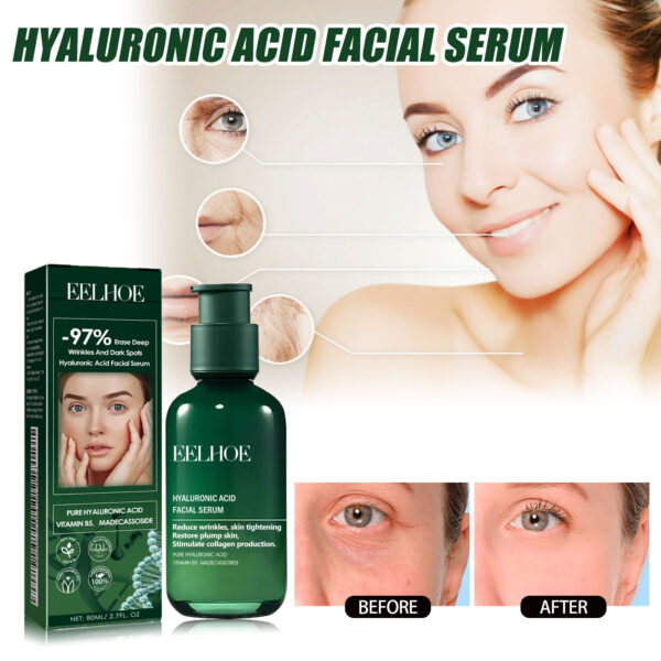 Facial Essence, Lifts And Tightens Facial Skin And Reduces Fine Lines And Wrinkles