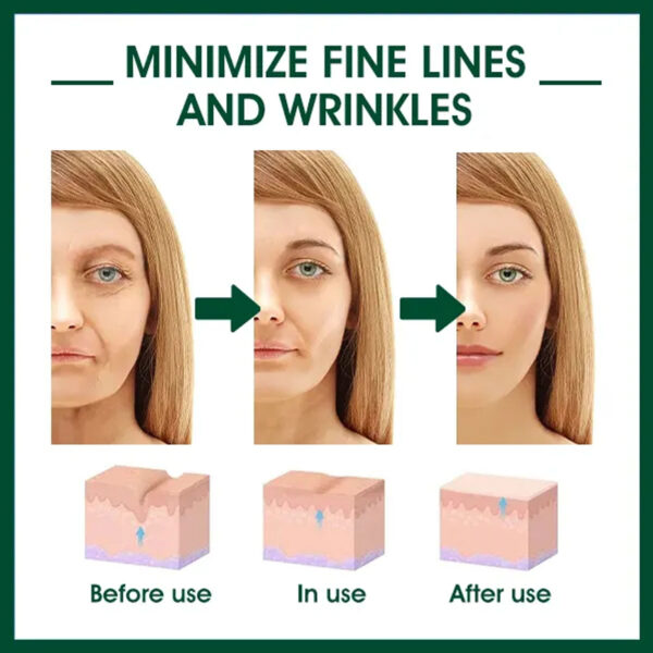 Facial Essence, Lifts And Tightens Facial Skin And Reduces Fine Lines And Wrinkles