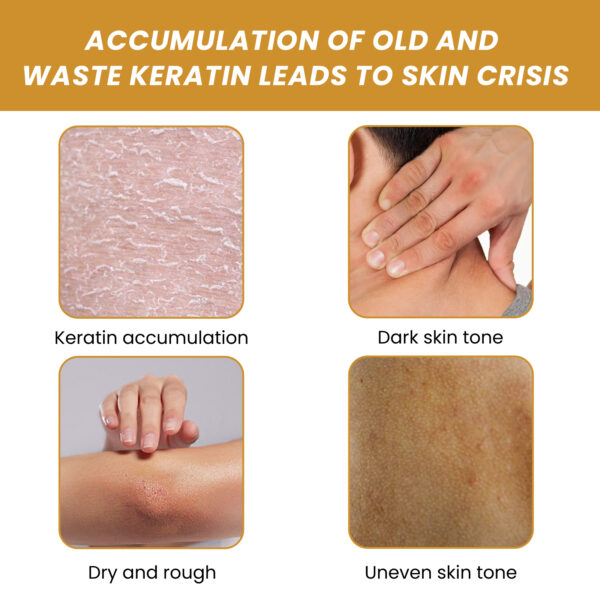 Turmeric Sugar Body Scrub, Fade Acne Mark Moisturizing Refreshing Smooth Tender Skin Cleansing Body Exfoliating Scrub