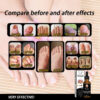 Nail Repair Solution Thickening And Brightening Nails Removing Gray Nail Repair Nourishing Nail Care Solution