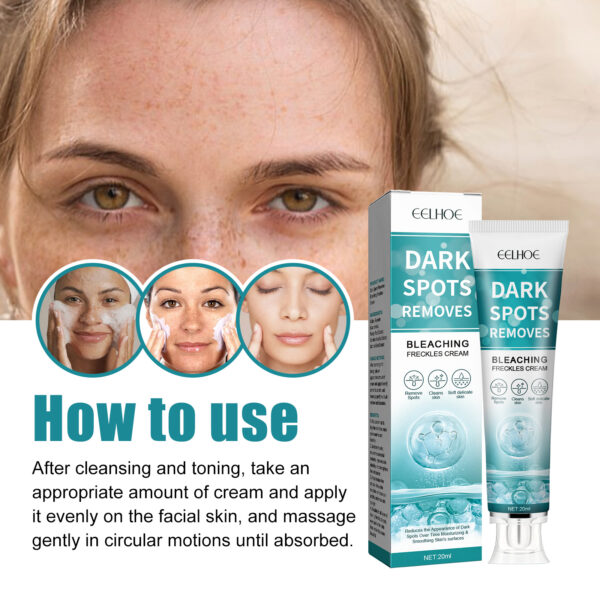 Whitening Spot Cream Hydrates And Moisturizes Skin To Lighten Spots, Acne Whitening, Brightening And Rejuvenating Skin Beauty Cream